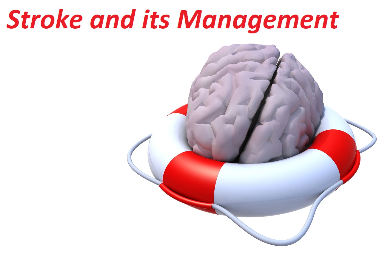 Stroke and its Management Photo